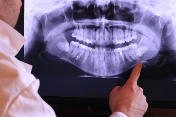 Best Emergency Dentist for Knocked-Out Tooth in Clermont, IN