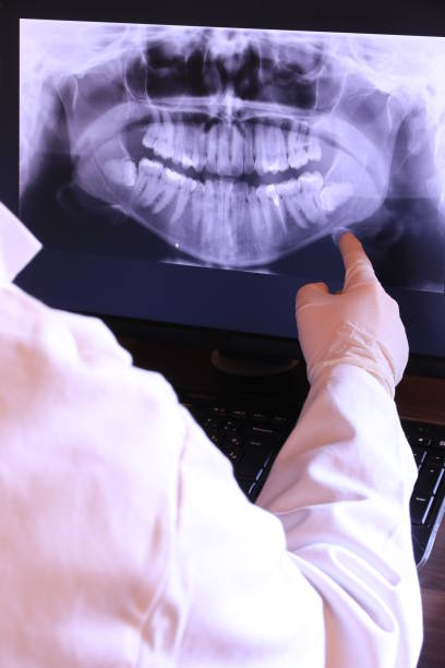 Best Emergency Dentist for Lost Fillings or Crowns in Clermont, IN