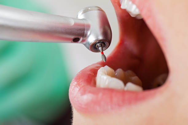 Best Pediatric Emergency Dentist in Clermont, IN